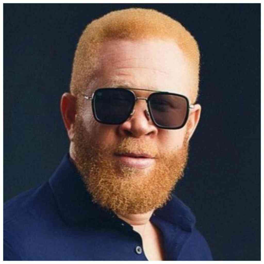 '.............. because I’m albino' – Damilola Ogunsin | MirrorLog