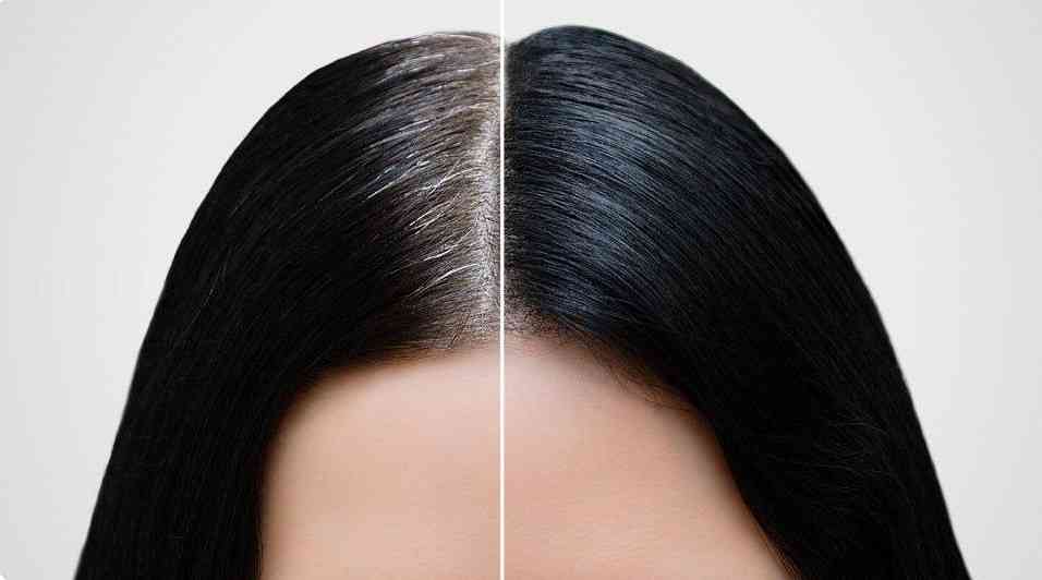 Gray hairs can naturally regain their original color when we feel less stressed. - MirrorLog