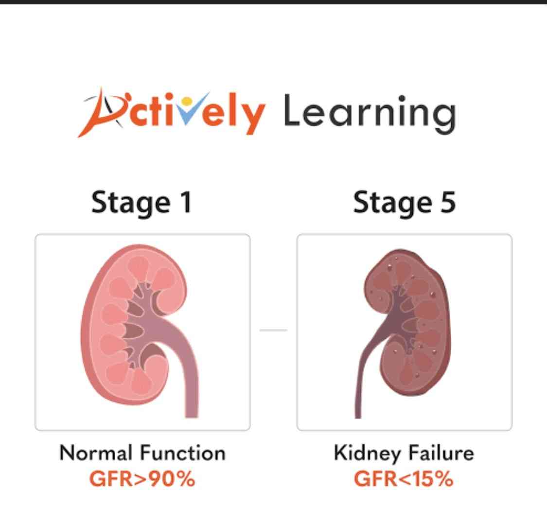 Stages of kidney disease - MirrorLog