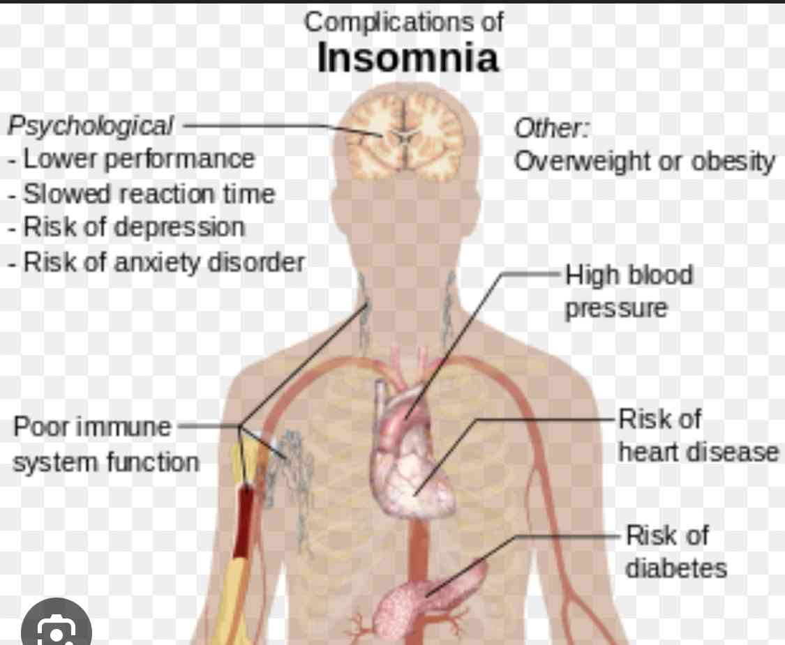 INSOMNIA | MirrorLog