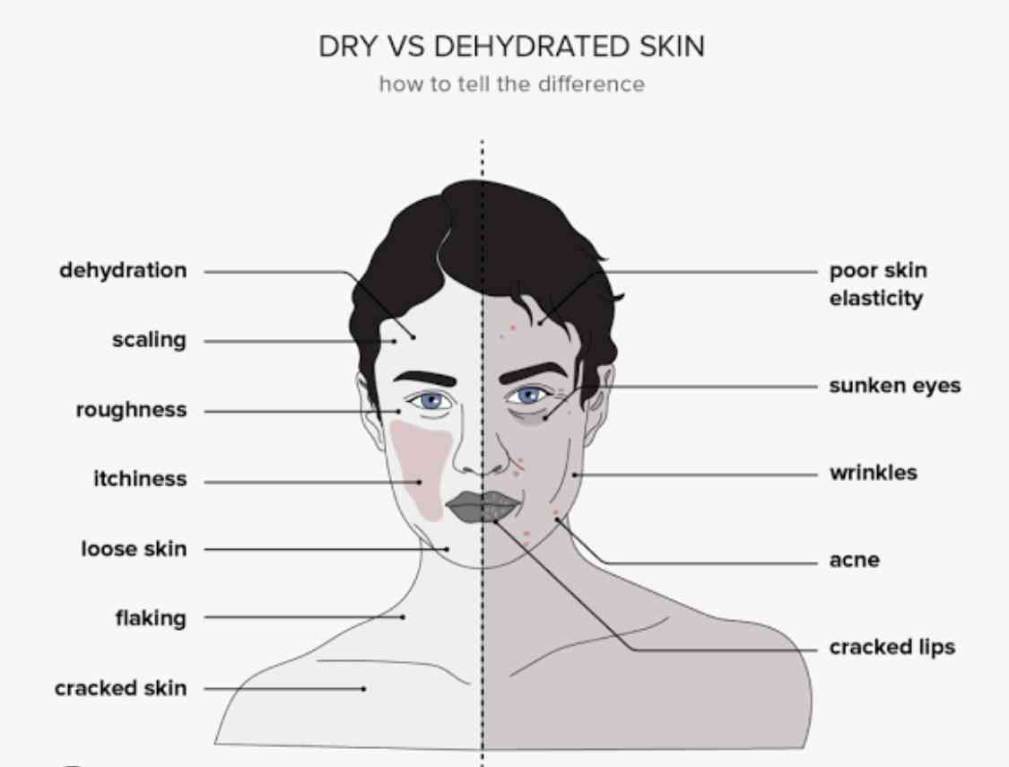 Causes of dehydration - MirrorLog