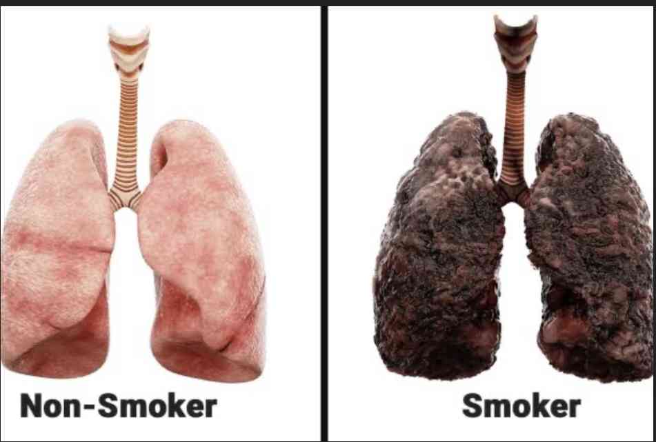 Risk factors of lung cancer - MirrorLog