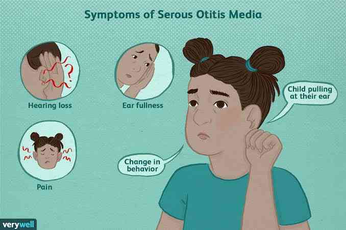 Symptoms of otitis media | MirrorLog