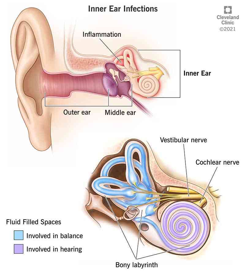 Risk factors of otitis media | MirrorLog