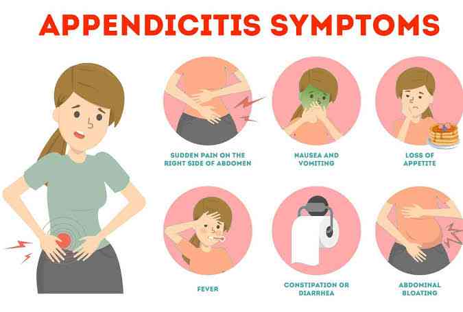 Signs and symptoms of Appendicitis - MirrorLog