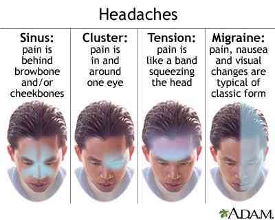 Causes of headaches | MirrorLog