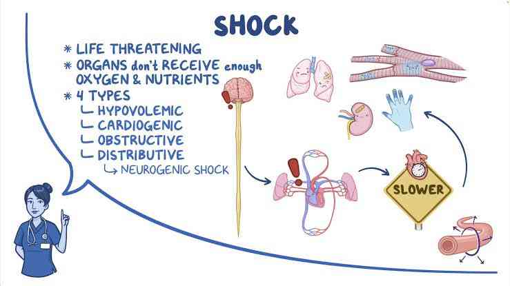 Shock - MirrorLog