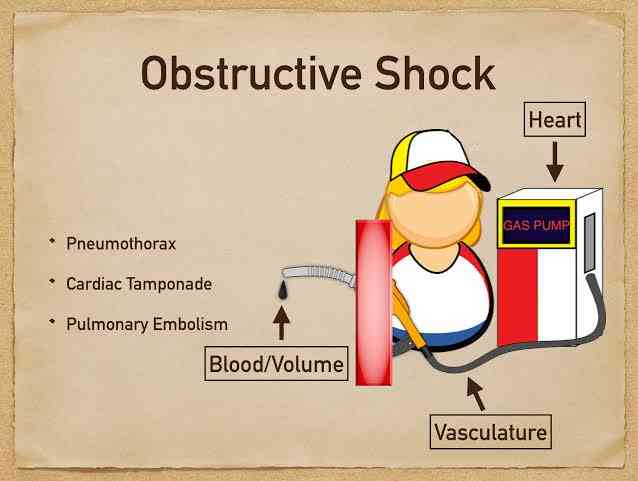 Obstructive Shock - MirrorLog