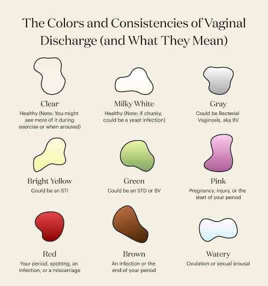 Colors of Vaginal Discharge - MirrorLog