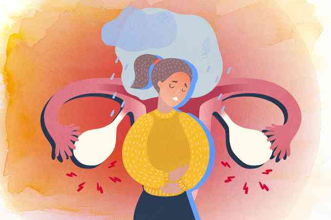 Premenstrual syndrome (PMS) - MirrorLog