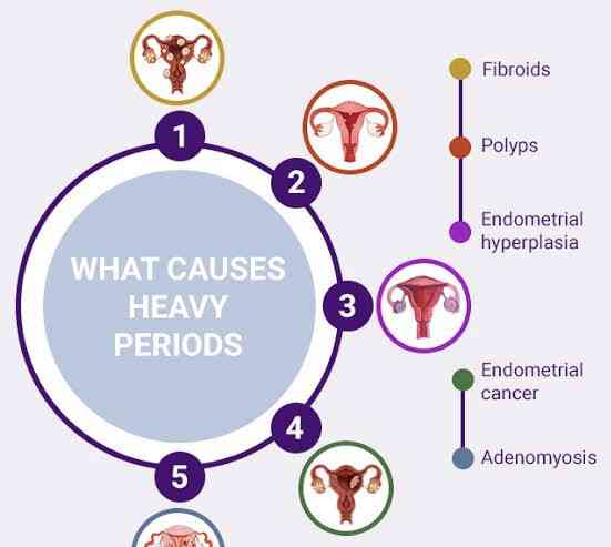 Causes of heavy period - MirrorLog