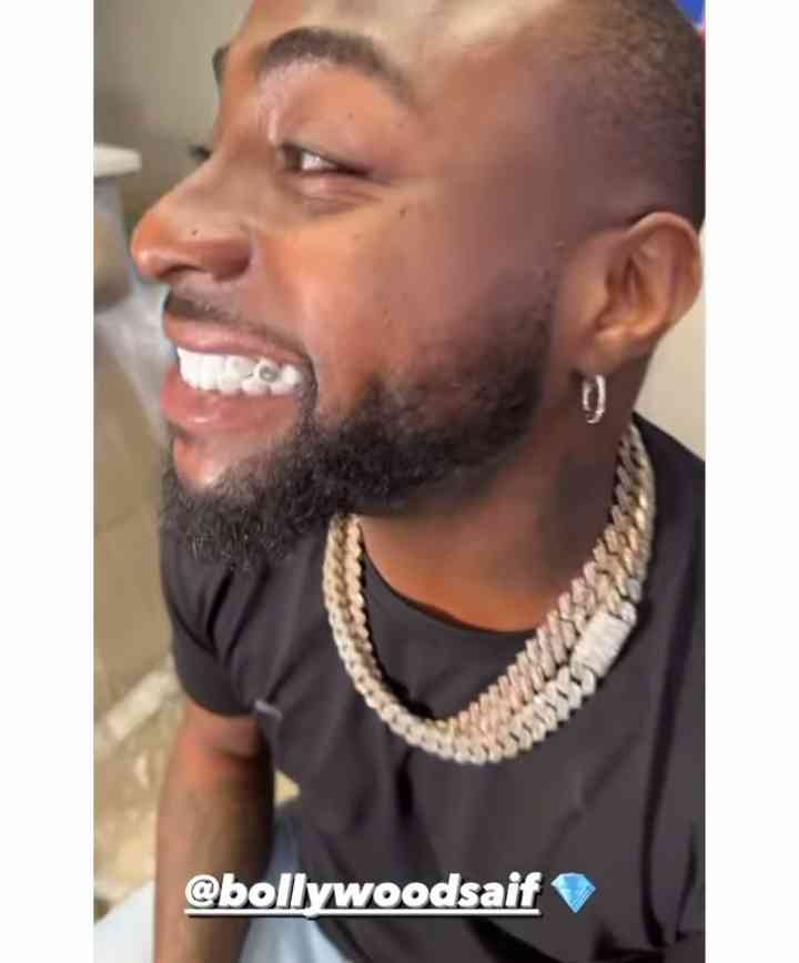 Singer, Davido flaunts new set of crystal white teeth - MirrorLog