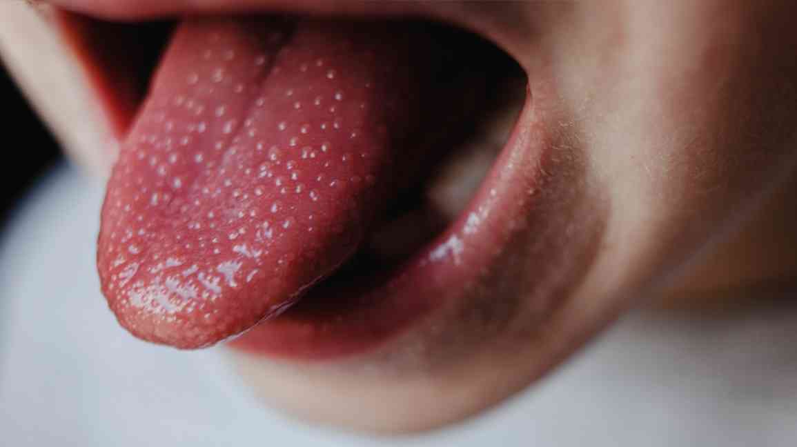 Scientists believe that many people snore because they have fat / large tongues. It's called Sleep Apnea! - MirrorLog