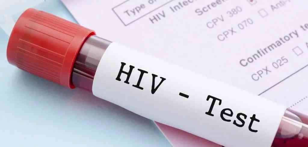 40 couple about to participate in mass wedding tested positive for HIV - MirrorLog